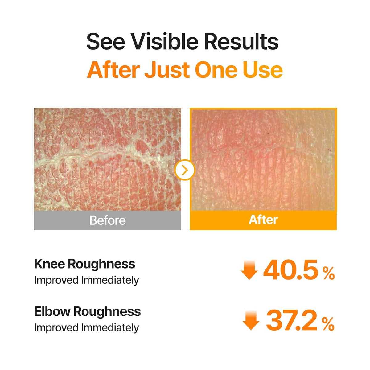 Exfoliation for All Skin Types