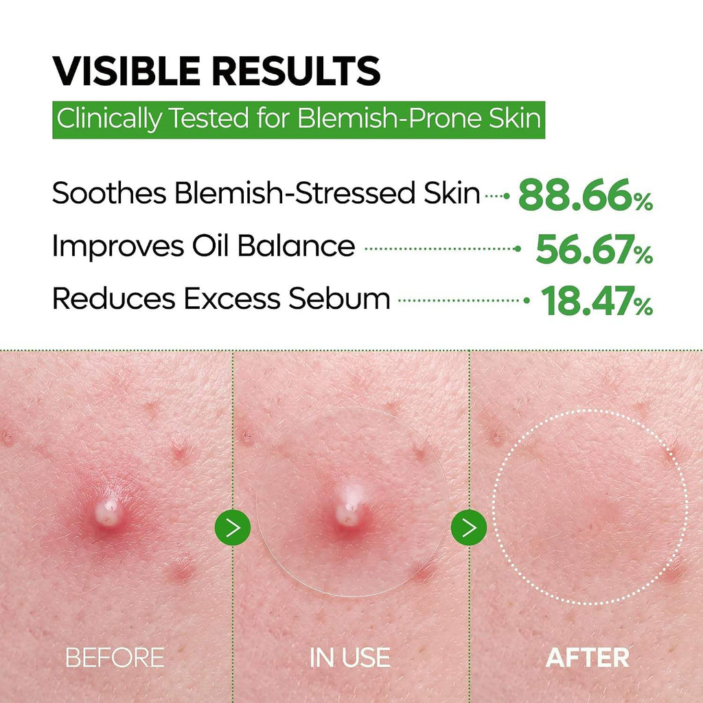 PROTOCOLE No.1 — Ultra-Thin Blemish Patch | 0.013 mm | 12 mm × 72 Patches